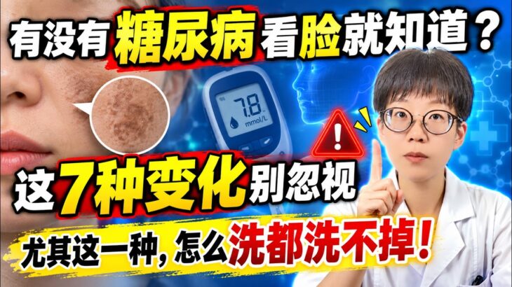 有没有糖尿病看脸就知道？这7种变化别忽视，尤其这一种，怎么洗都洗不掉！【安澜谈健康】#糖尿病 #糖尿病前期 #胰岛素抵抗 #黑棘皮病 #皮肤信号 #脖子发黑 #皮赘 #睑黄瘤 #口渴尿多 #伤口难愈合