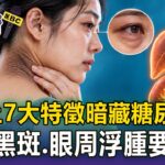 身上7大特徵「暗藏糖尿病警訊」！ 脖子黑斑、眼周浮腫竟是「器官泡糖水」？【東森醫起看】【57健康同學會】