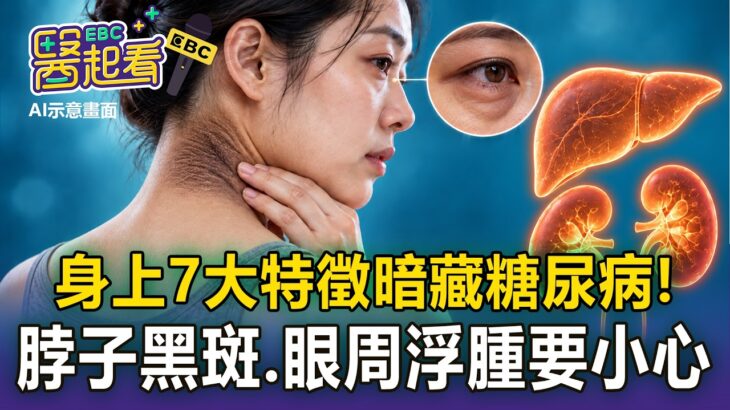 身上7大特徵「暗藏糖尿病警訊」！ 脖子黑斑、眼周浮腫竟是「器官泡糖水」？【東森醫起看】【57健康同學會】