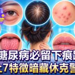 凡糖尿病必留下痕跡？身上7特徵暗藏休克警訊！【57健康同學會】20260906｜蕭捷健、葉懿昕、許瓊月、江中博、徐俊相、張予馨
