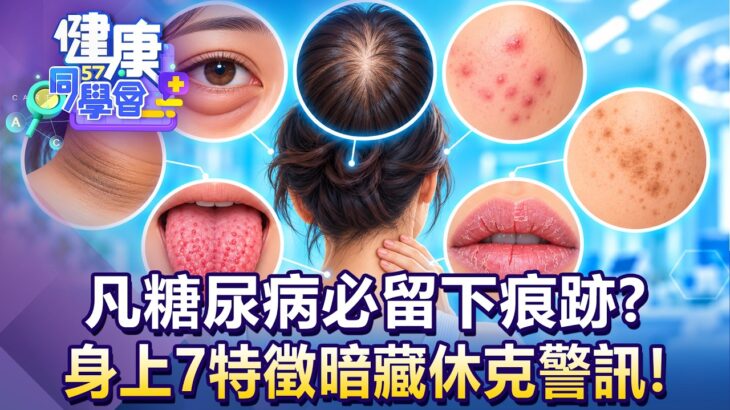 凡糖尿病必留下痕跡？身上7特徵暗藏休克警訊！【57健康同學會】20260906｜蕭捷健、葉懿昕、許瓊月、江中博、徐俊相、張予馨