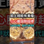 眼皮長黃色斑塊？眼瞼黃瘤可能和 LDL、ApoB、甲狀腺有關 #黃瘤病#眼瞼 #糖尿病 #血脂 #膽固醇 #脂蛋白 #粥狀硬化