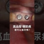 有高血壓、糖尿病，還可以植牙嗎【祐民牙醫－隱適美旗艦店】許文斌醫師（大許醫師） #高血壓#糖尿病#骨質疏鬆#植牙
