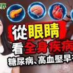 驗眼不只查視力！糖尿病、高血壓可能早有警訊，眼睛可如何透露全身健康狀況？｜健康新視界