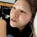 妊娠糖尿病になった