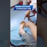 糖尿病特有微血管病變！無聲侵蝕全身微小血管 #糖尿病 #糖尿病血管病變 #糖尿病神經病變