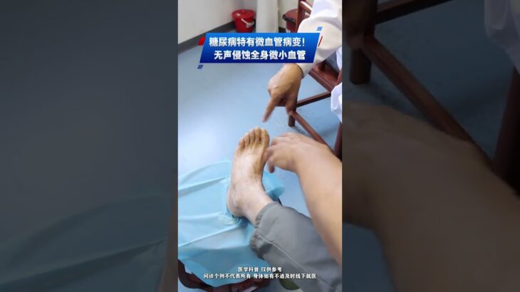 糖尿病特有微血管病變！無聲侵蝕全身微小血管 #糖尿病 #糖尿病血管病變 #糖尿病神經病變