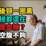 全台糖尿病破250萬人！臉和脖子這5個訊號，出現1個就該驗：免費健檢血糖正常，可能還差這1項沒驗！