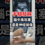 手腳麻是中風嗎？糖尿病、頸椎壓迫、腕隧道，4種麻一次分清！ #手麻  #腳麻 #血糖 #血脂 #中風 #神經 #頸椎  #骨刺