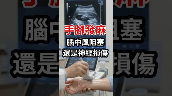 手腳麻是中風嗎？糖尿病、頸椎壓迫、腕隧道，4種麻一次分清！ #手麻  #腳麻 #血糖 #血脂 #中風 #神經 #頸椎  #骨刺