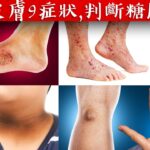【皮膚】皮膚9症狀, 判斷糖尿病,降血糖自然療法,柏格醫生 Dr Berg