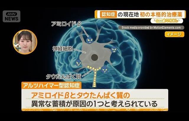 医療の未来予想図　どうなる？感染症・がん・糖尿病　AI診察は【グッド！いちおし】【グッド！モーニング】(2026年10月22日)