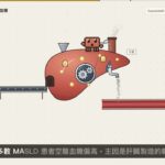 當糖尿病遇上肝臟：MASLD 該不該篩檢？EASD 2026 Diabetologia