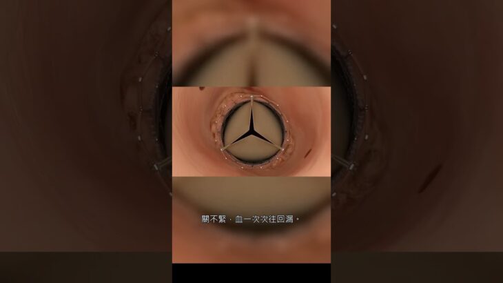 一張「糖尿病藥」標籤，藏了上千條人命｜完整破案在長片