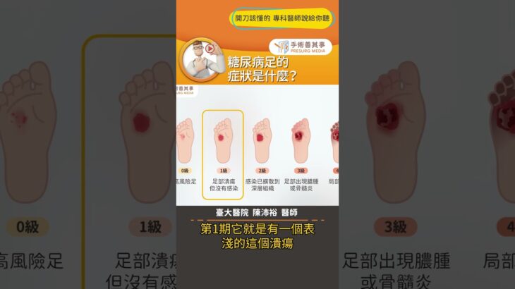 【糖尿病足的症狀有哪些？】 #糖尿病足 #末梢循環 #截肢 #手術善其事 #陳沛裕醫師