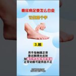 糖尿病足要怎麼自查，記住四個字 #糖尿病足